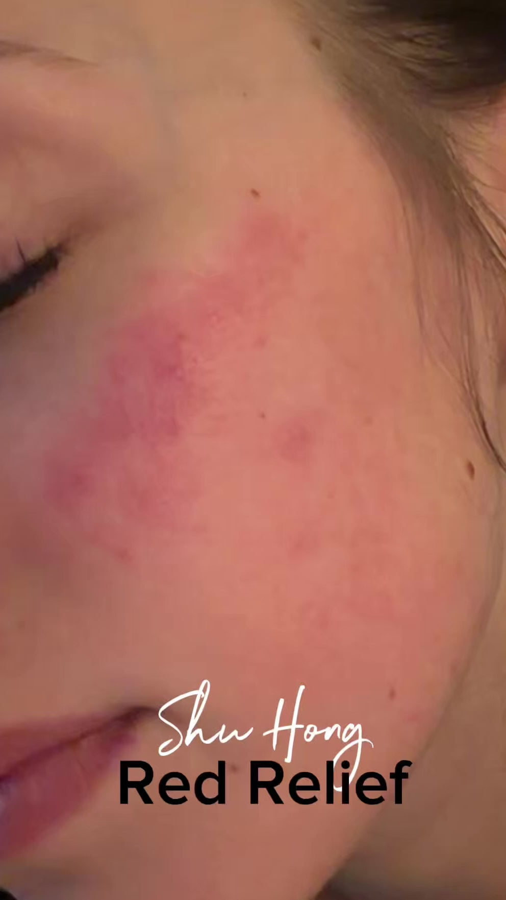 Skin Care Combo